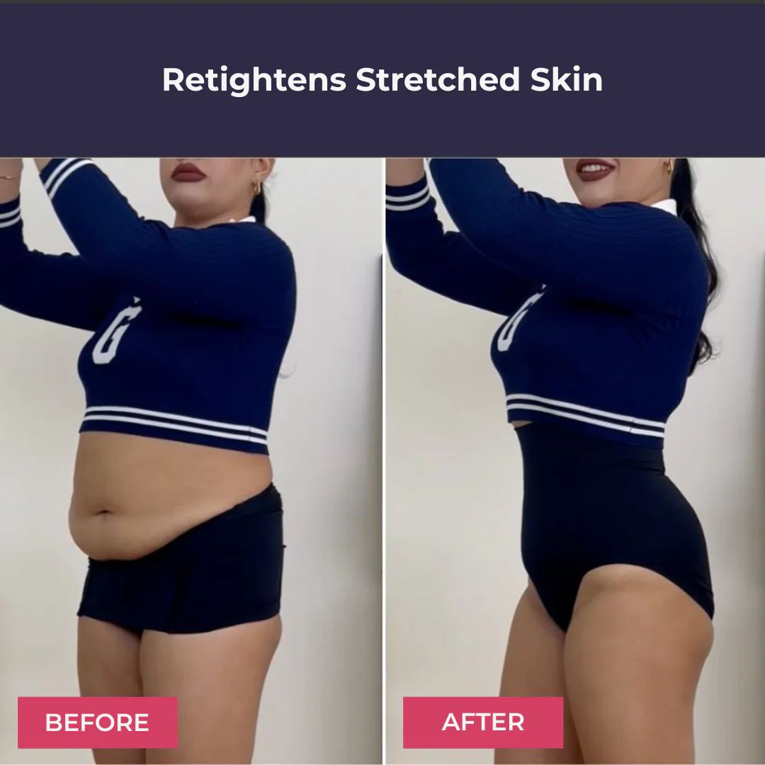 LACULOTTE™ ||| Tummy Control & 3D massage Panty (up) - Image 8