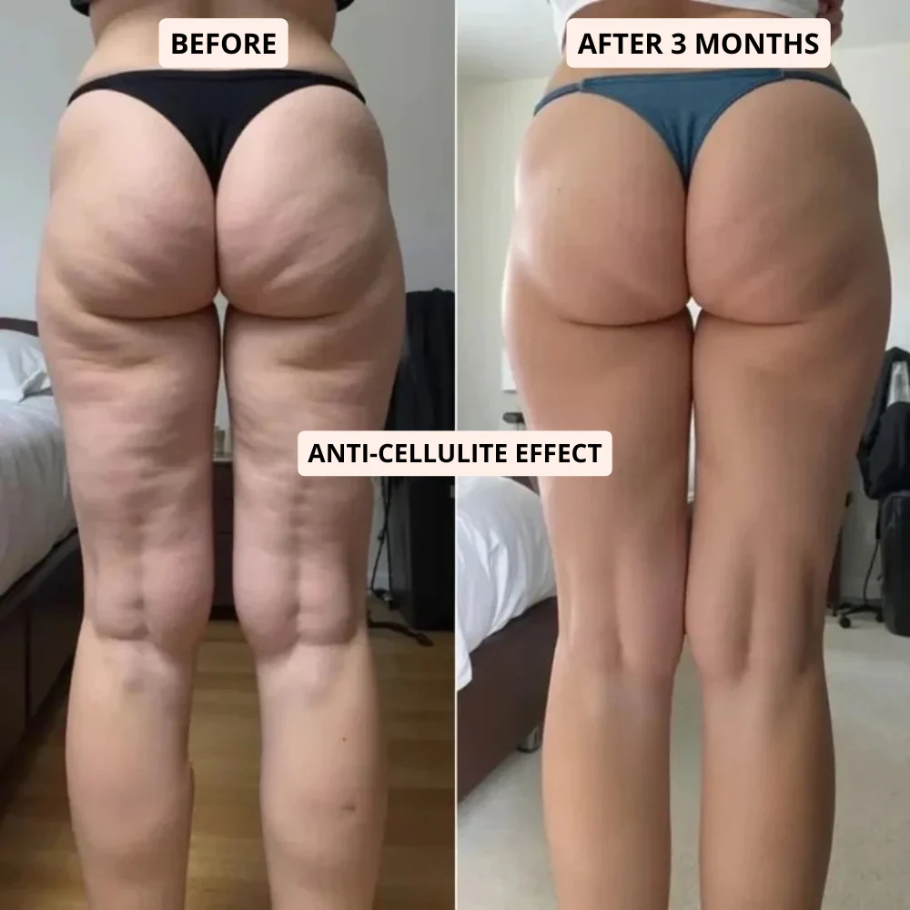 Anti-Cellulite Leggings - Compression and High Waist for tummy control. - Image 5