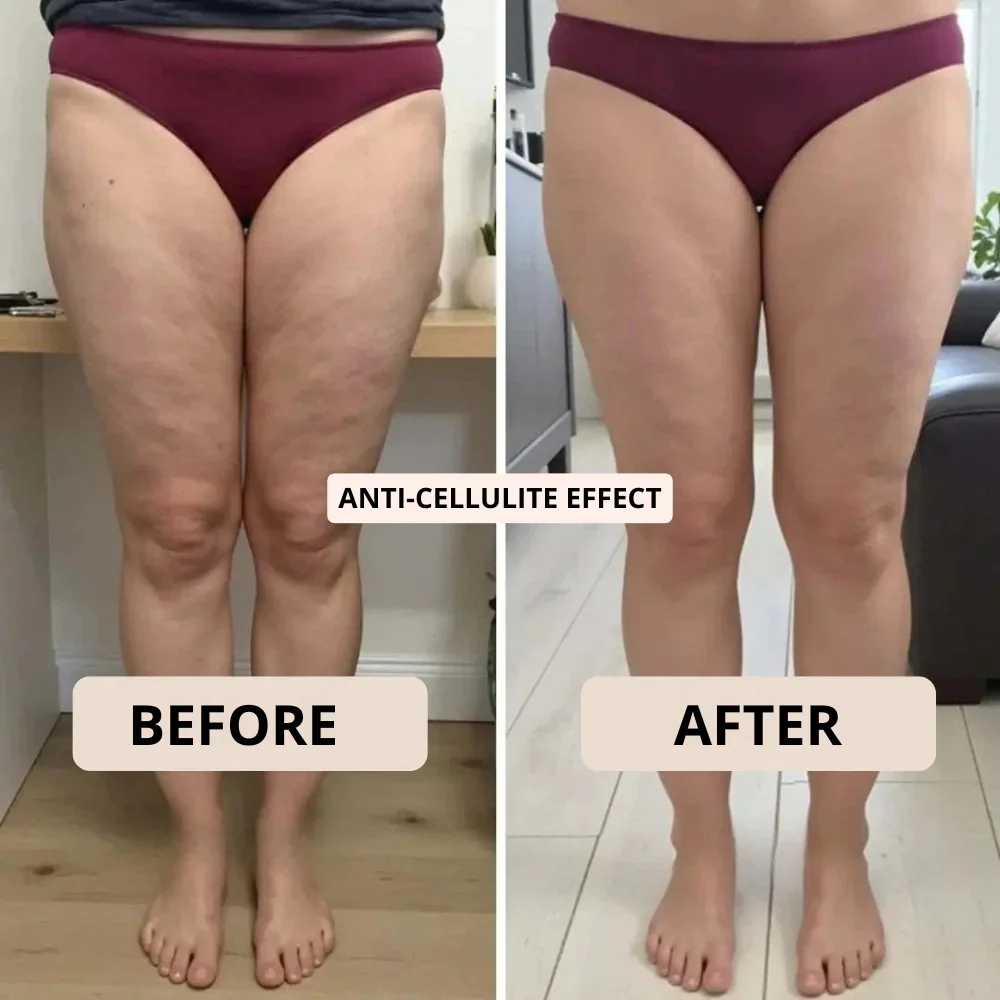 Anti-Cellulite Leggings - Compression and High Waist for tummy control. - Image 6